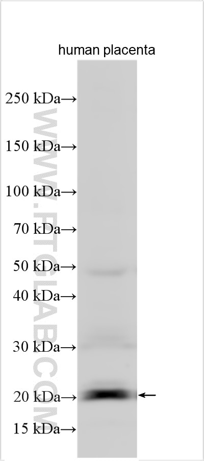 Western Blot (WB) analysis of various lysates using PLAAT3 Polyclonal antibody (55209-1-AP)