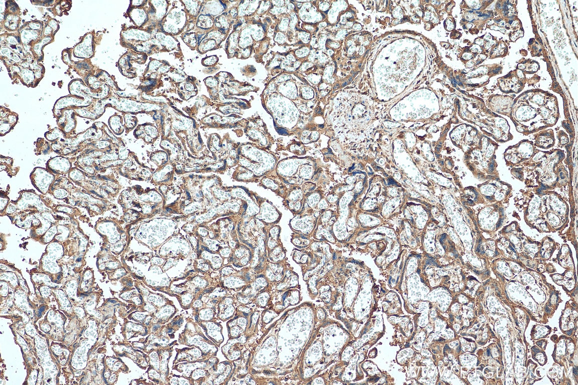Immunohistochemistry (IHC) staining of human placenta tissue using PLAC1 Polyclonal antibody (26838-1-AP)