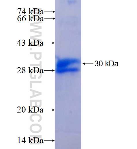 PLAC1 fusion protein Ag25231 SDS-PAGE