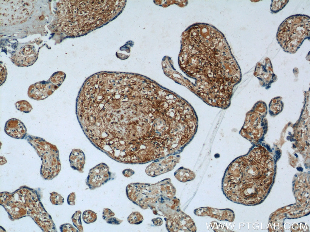 Immunohistochemistry (IHC) staining of human placenta tissue using PLAC1L Polyclonal antibody (17343-1-AP)