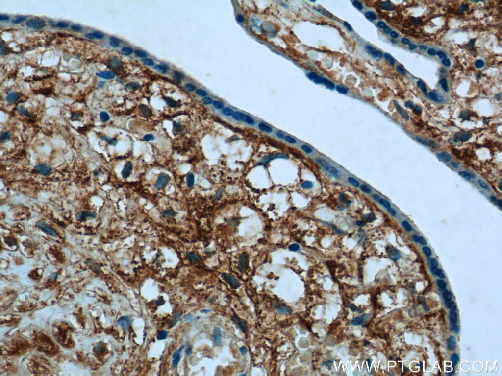Immunohistochemistry (IHC) staining of human placenta tissue using PLAC1L Polyclonal antibody (17343-1-AP)