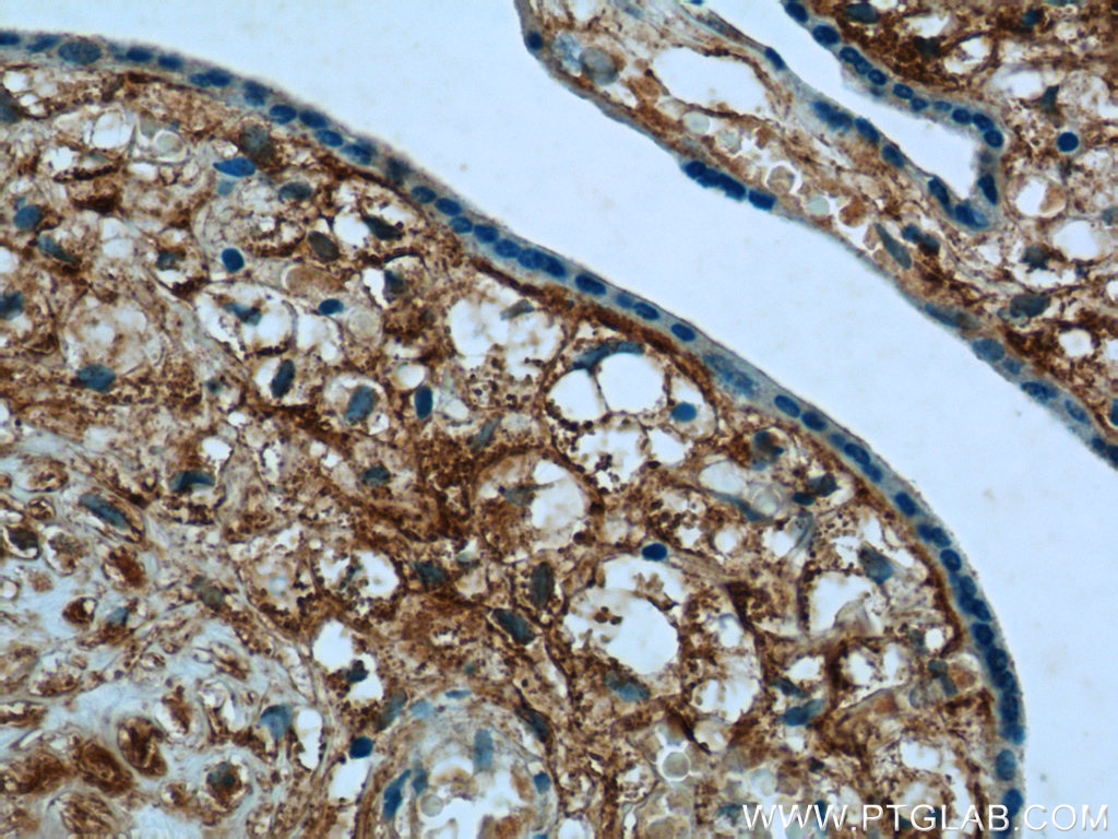 IHC staining of human placenta using 17343-1-AP