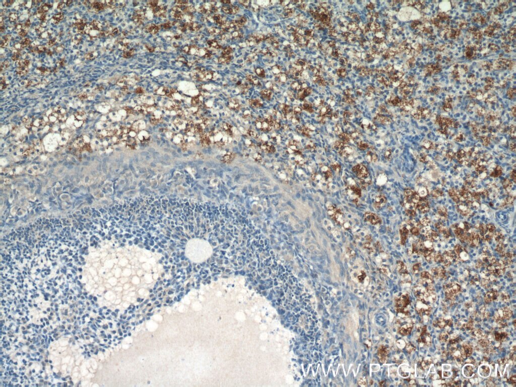 Immunohistochemistry (IHC) staining of human ovary tissue using PLAC1L Polyclonal antibody (17343-1-AP)