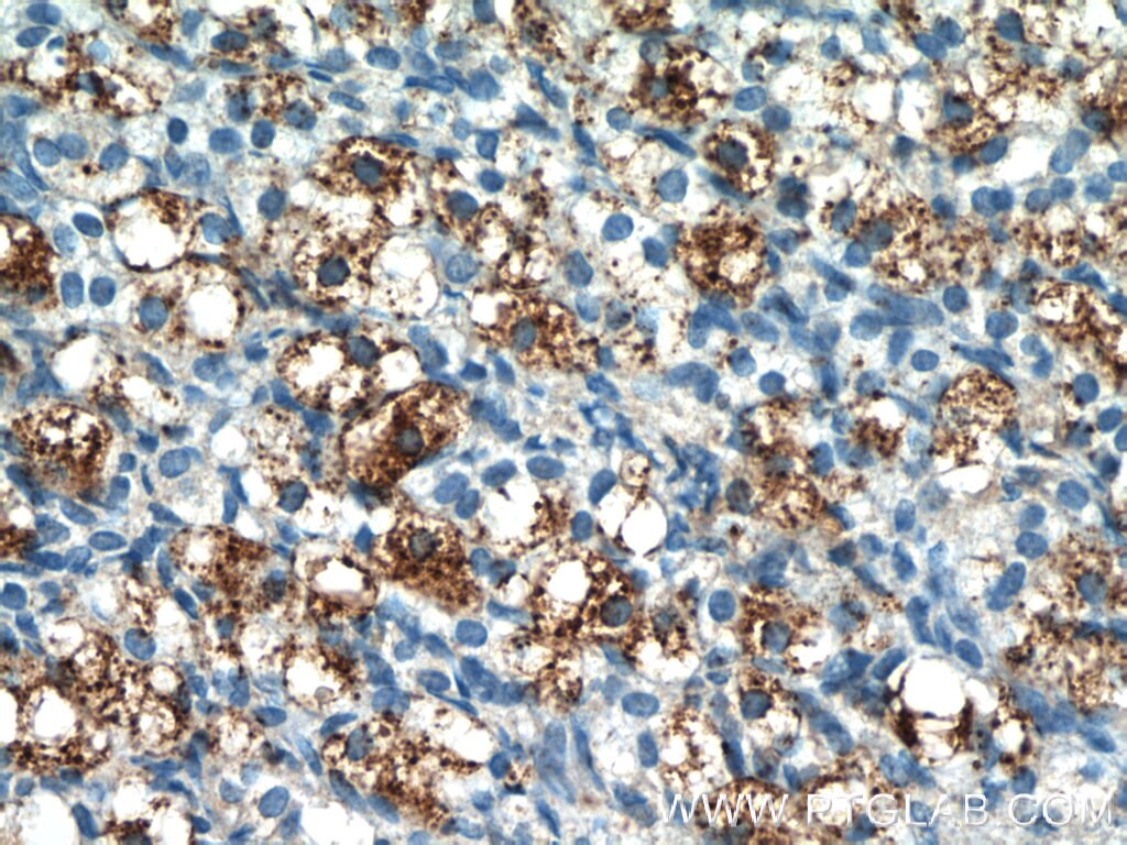 Immunohistochemistry (IHC) staining of human ovary tissue using PLAC1L Polyclonal antibody (17343-1-AP)