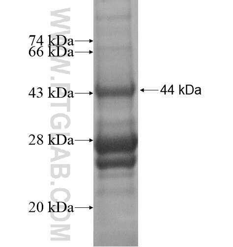 PLAC2 fusion protein Ag15458 SDS-PAGE