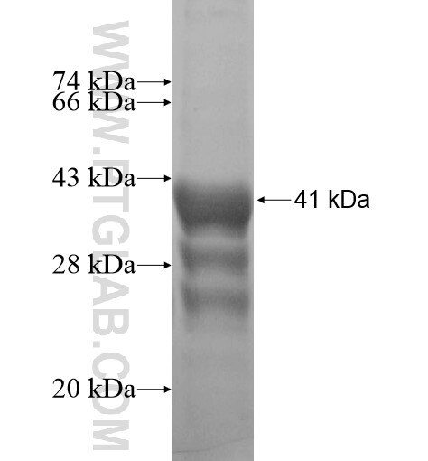 PLAC4 fusion protein Ag12809 SDS-PAGE