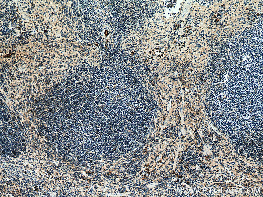 Immunohistochemistry (IHC) staining of mouse spleen tissue using PLAC8 Polyclonal antibody (12284-1-AP)