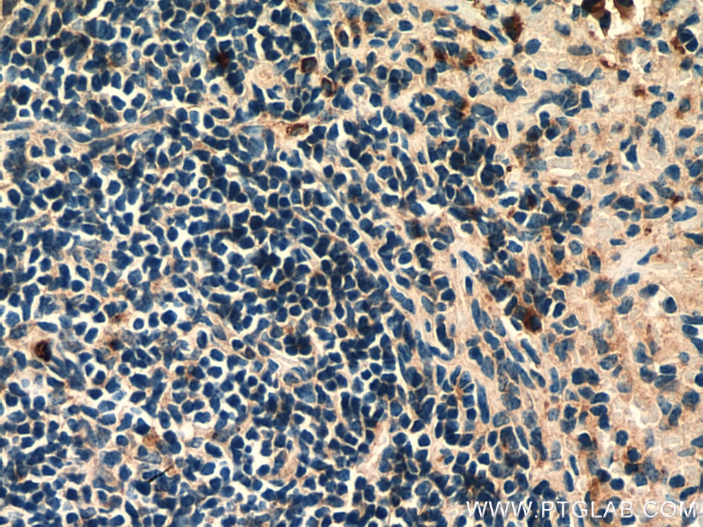Immunohistochemistry (IHC) staining of mouse spleen tissue using PLAC8 Polyclonal antibody (12284-1-AP)