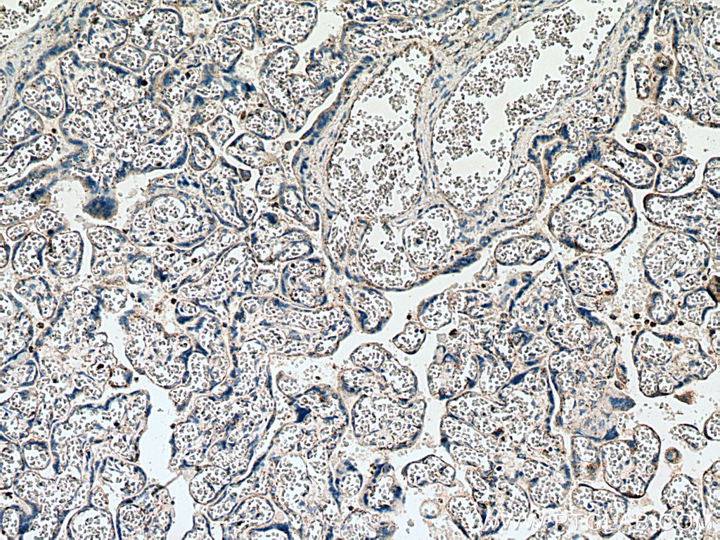 IHC staining of human placenta using 12284-1-AP