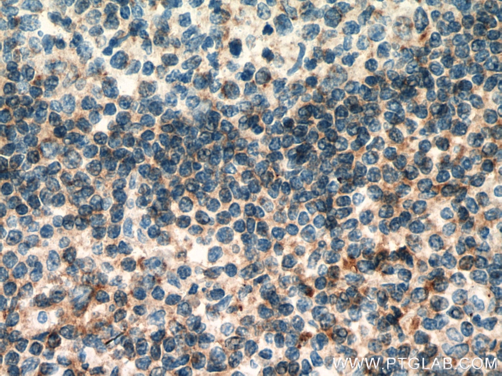 Immunohistochemistry (IHC) staining of human tonsillitis tissue using PLAC8 Polyclonal antibody (12284-1-AP)