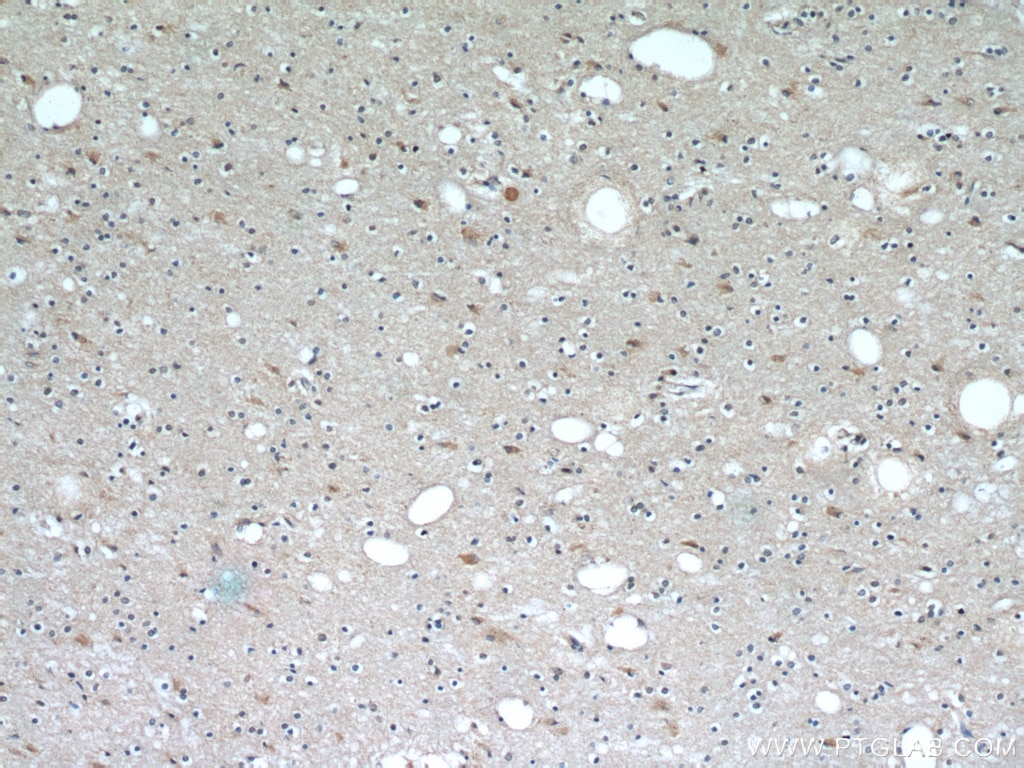 Immunohistochemistry (IHC) staining of human brain tissue using PLAC8 Polyclonal antibody (12284-1-AP)