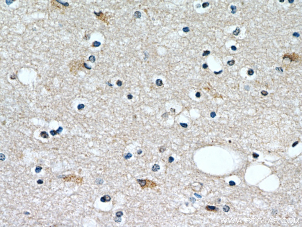 Immunohistochemistry (IHC) staining of human brain tissue using PLAC8 Polyclonal antibody (12284-1-AP)
