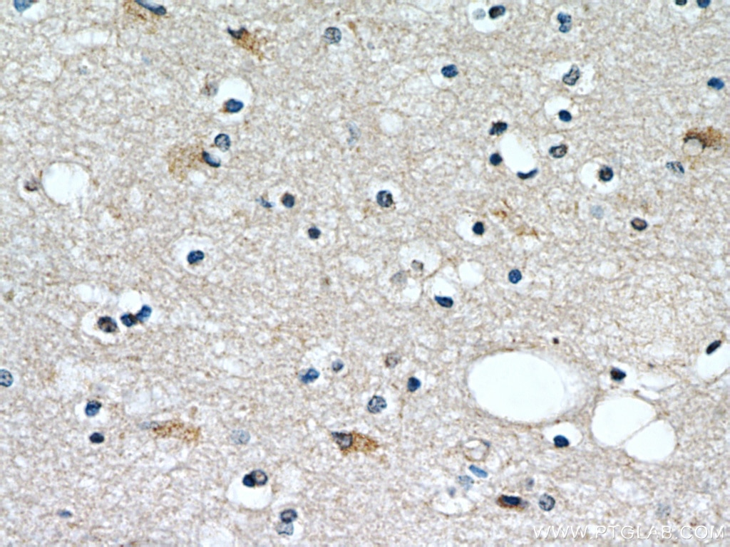 IHC staining of human brain using 12284-1-AP