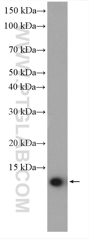 Western Blot (WB) analysis of human peripheral blood leukocyte using PLAC8 Polyclonal antibody (12284-1-AP)