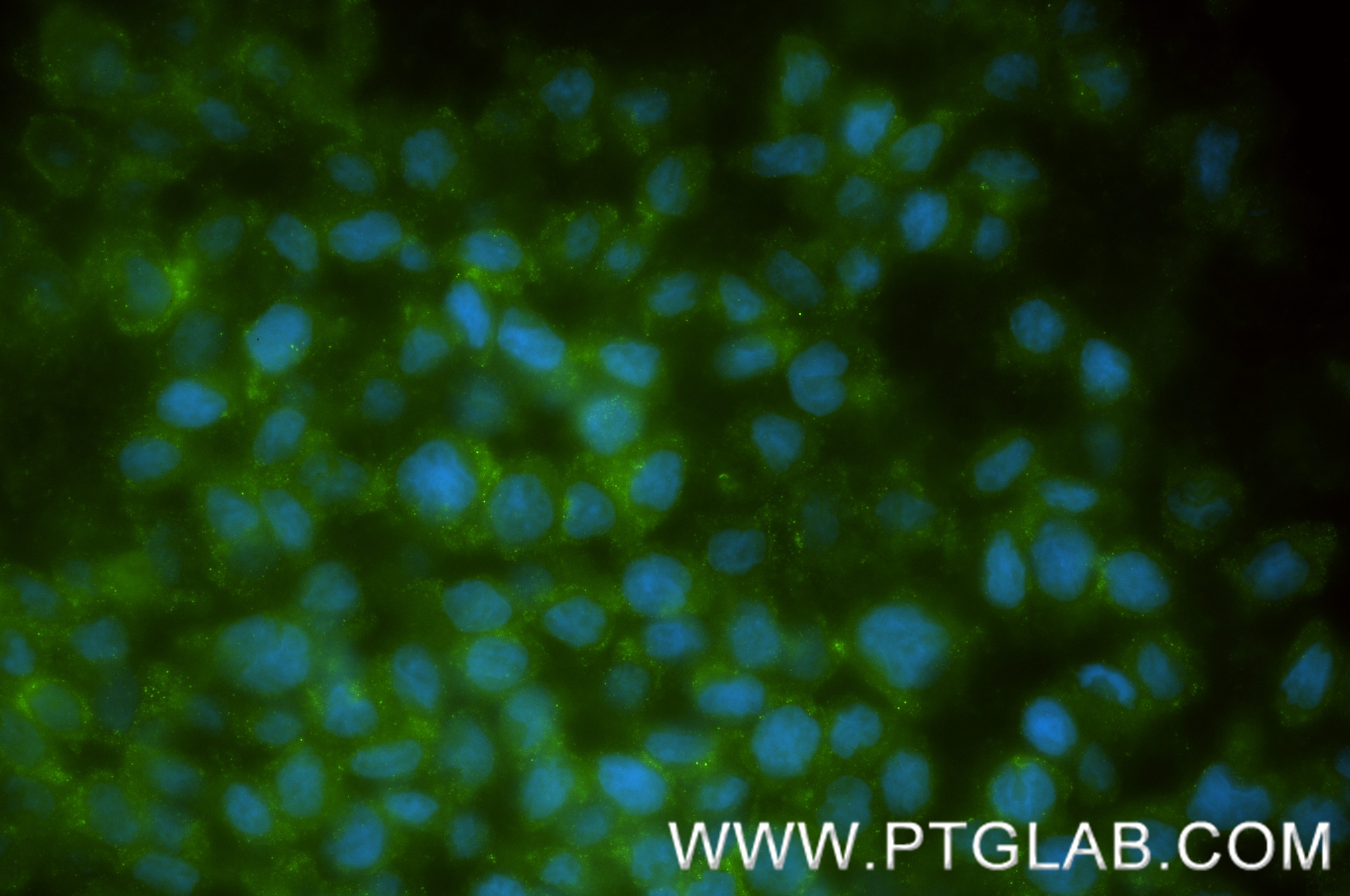 Immunofluorescence (IF) / fluorescent staining of THP-1 cells using PLAC8 Recombinant monoclonal antibody (87918-1-RR)