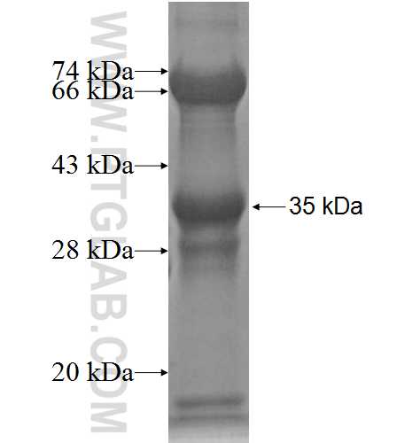 PLAC8 fusion protein Ag2939 SDS-PAGE