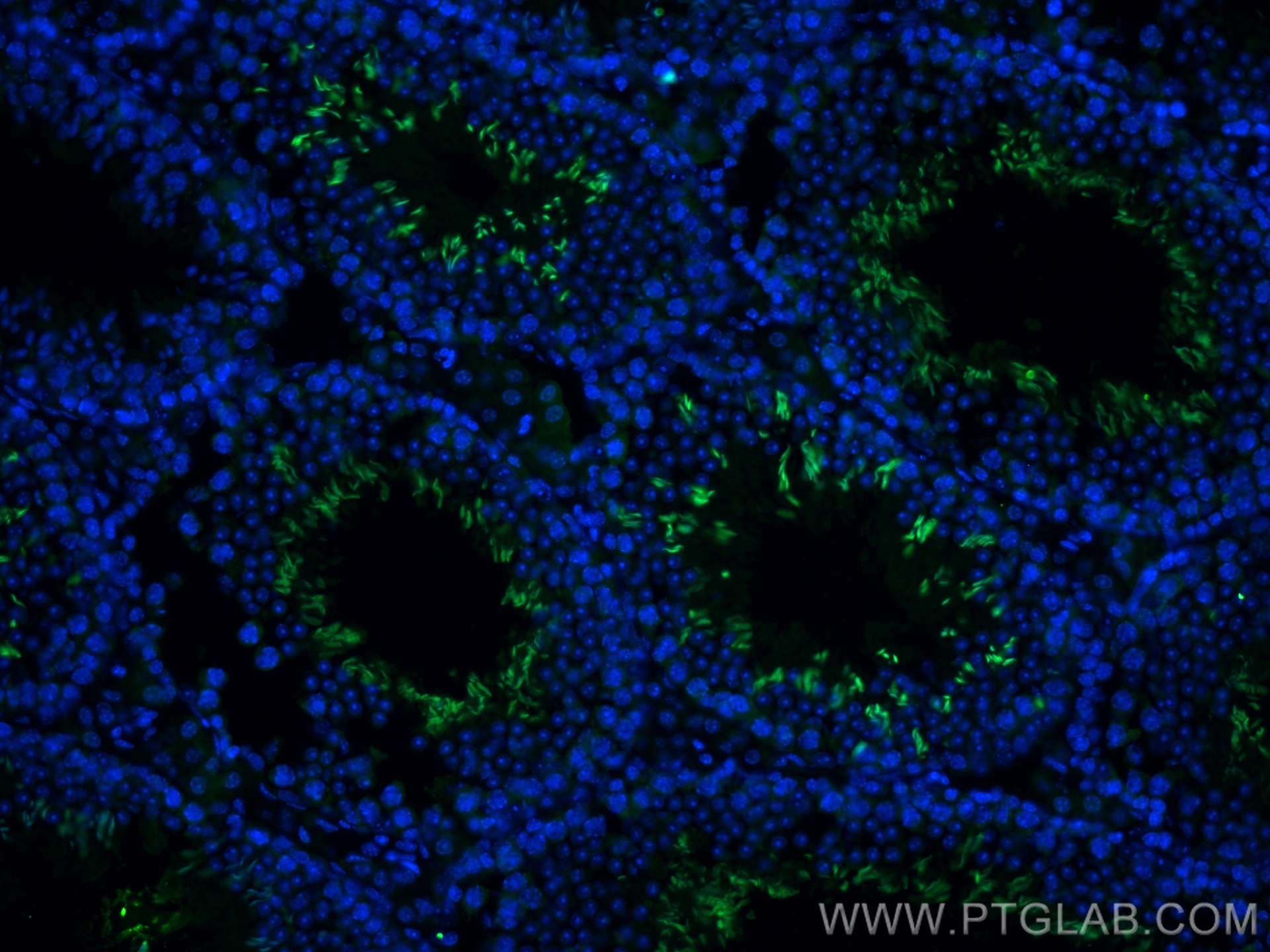 Immunofluorescence (IF) / fluorescent staining of mouse testis tissue using PLAC9 Polyclonal antibody (17910-1-AP)