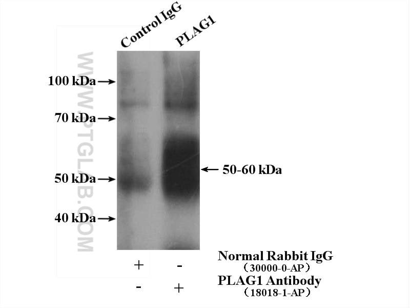Immunoprecipitation (IP) experiment of HepG2 cells using PLAG1 Polyclonal antibody (18018-1-AP)