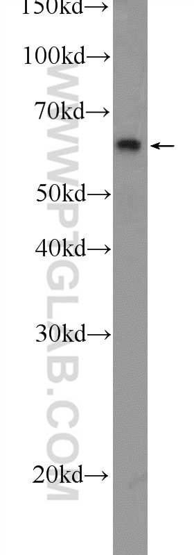 Western Blot (WB) analysis of HepG2 cells using PLAG1 Polyclonal antibody (18018-1-AP)