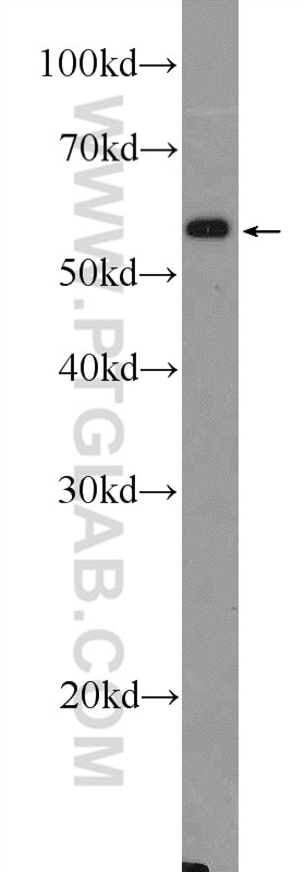 Western Blot (WB) analysis of A431 cells using PLAG1 Polyclonal antibody (18018-1-AP)