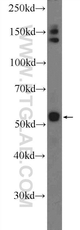 Western Blot (WB) analysis of mouse heart tissue using PLAGL1 Polyclonal antibody (25864-1-AP)