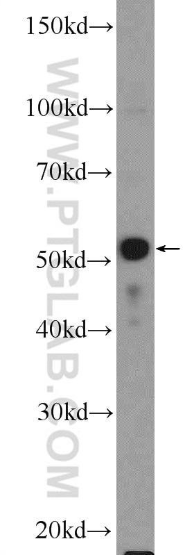 Western Blot (WB) analysis of MCF-7 cells using PLAGL1 Polyclonal antibody (25864-1-AP)