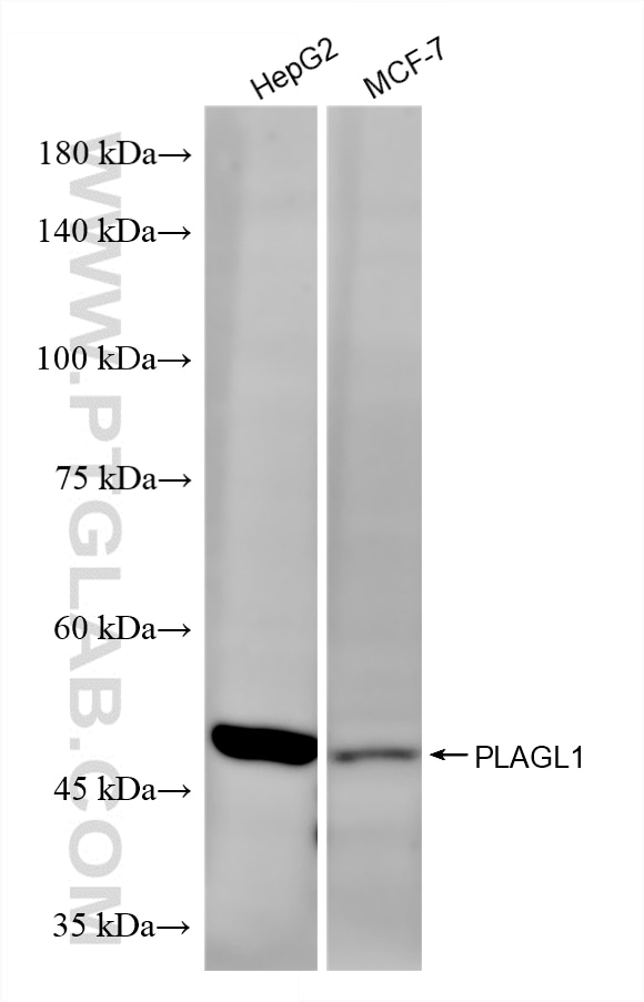 WB analysis using 87281-1-RR Western Blot (WB) analysis of various lysates using PLAGL1 Recombinant monoclonal antibody (87281-1-RR)