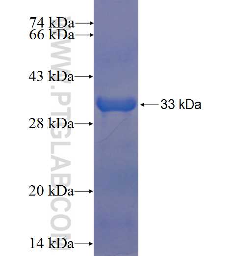 PLAGL1 fusion protein Ag23073 SDS-PAGE