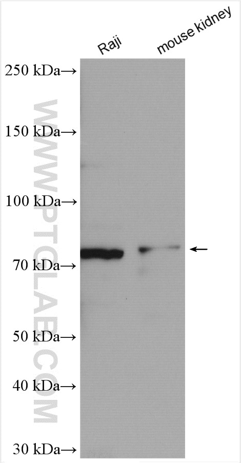 Western Blot (WB) analysis of various lysates using PLAGL2 Polyclonal antibody (11540-1-AP)