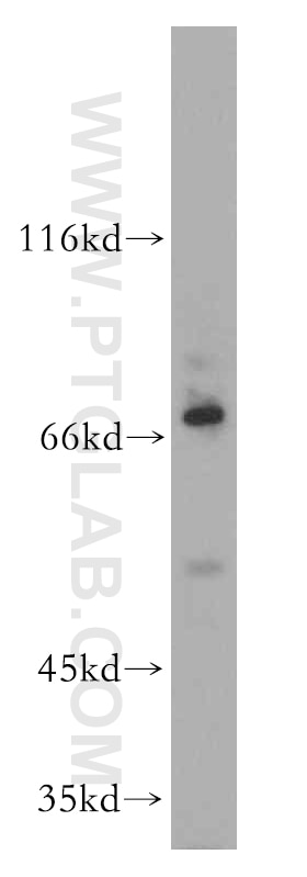 PLAGL2 Polyclonal antibody