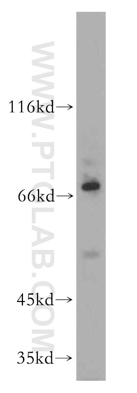 PLAGL2 Polyclonal antibody