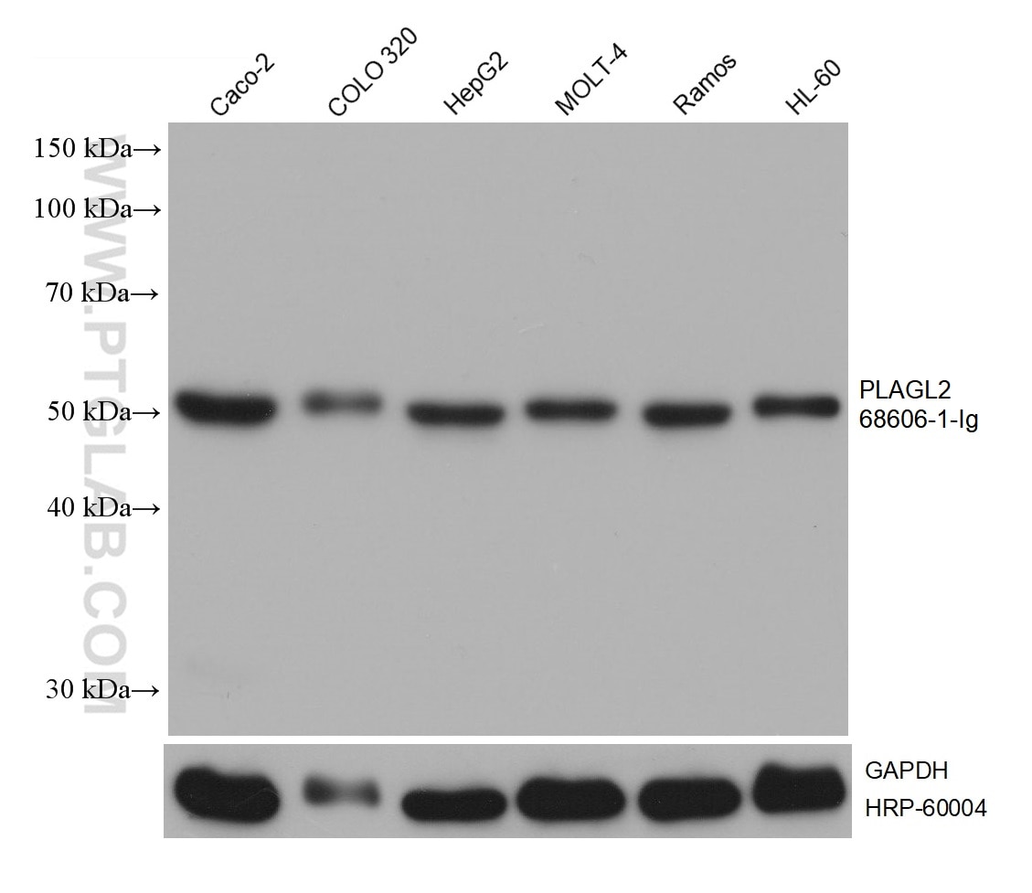 Western Blot (WB) analysis of various lysates using PLAGL2 Monoclonal antibody (68606-1-Ig)