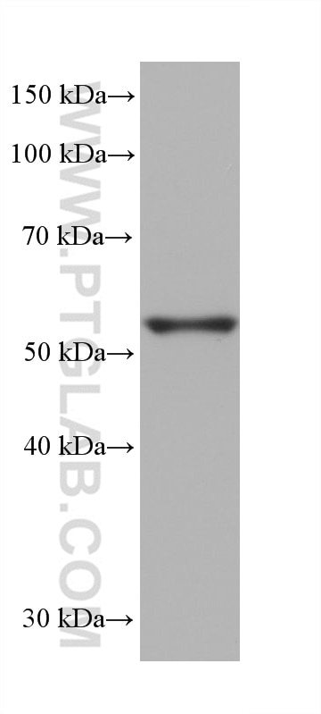 Western Blot (WB) analysis of rabbit testis tissue using PLAGL2 Monoclonal antibody (68606-1-Ig)
