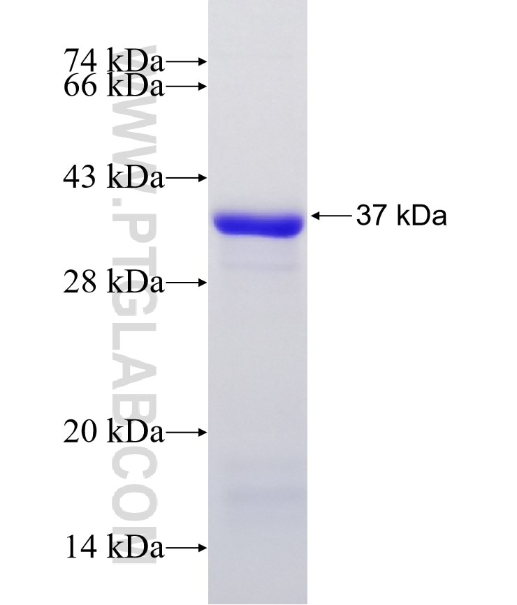 PLAGL2 fusion protein Ag30227 SDS-PAGE