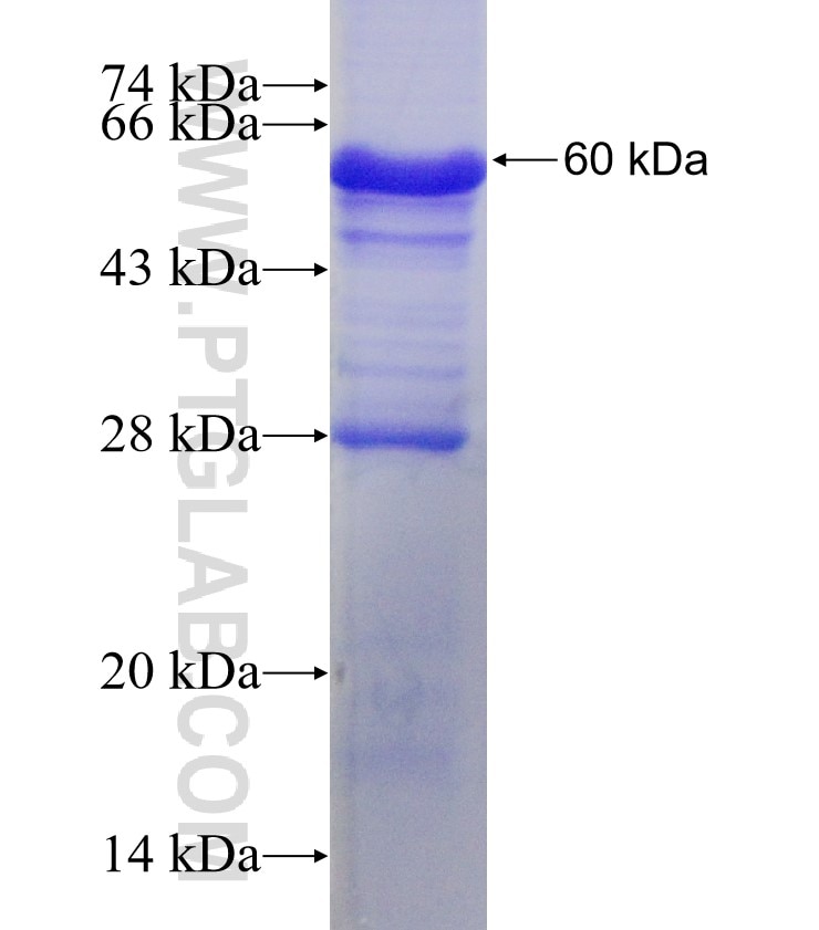 PLAGL2 fusion protein Ag2137 SDS-PAGE