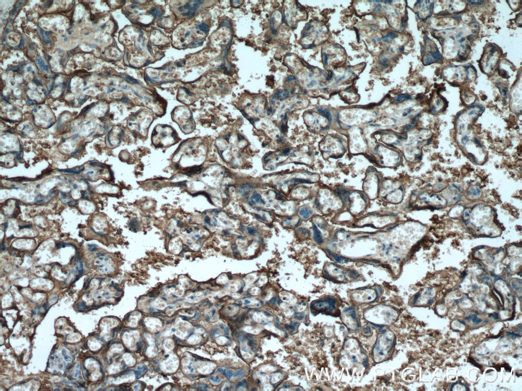 Immunohistochemistry (IHC) staining of human placenta tissue using PLAP Monoclonal antibody (60294-1-Ig)