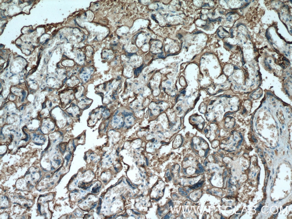 Immunohistochemistry (IHC) staining of human placenta tissue using PLAP Monoclonal antibody (60294-1-Ig)