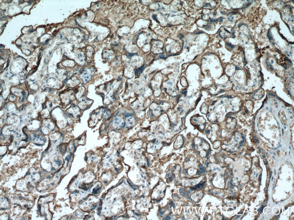 IHC staining of human placenta using 60294-1-Ig