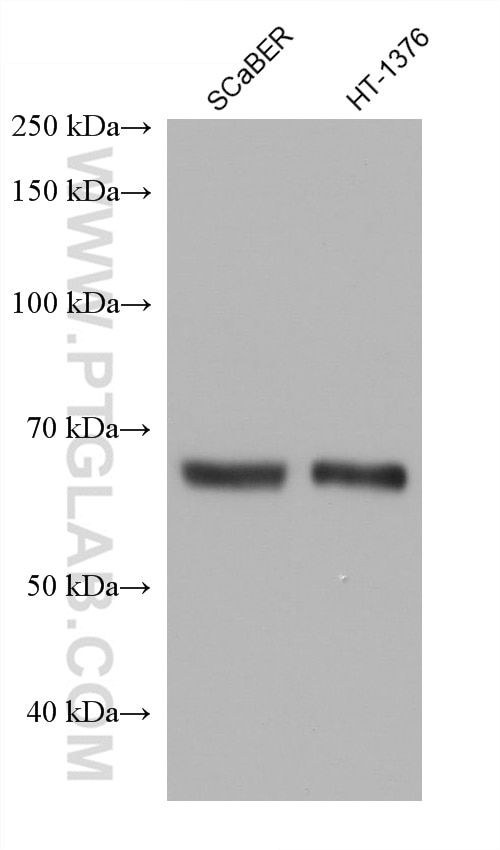 Western Blot (WB) analysis of various lysates using PLAP Monoclonal antibody (60294-1-Ig)