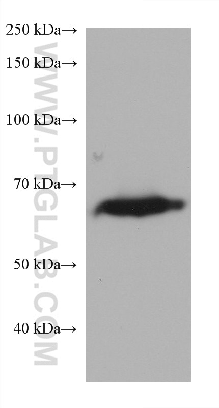 Western Blot (WB) analysis of human placenta tissue using PLAP Monoclonal antibody (60294-1-Ig)