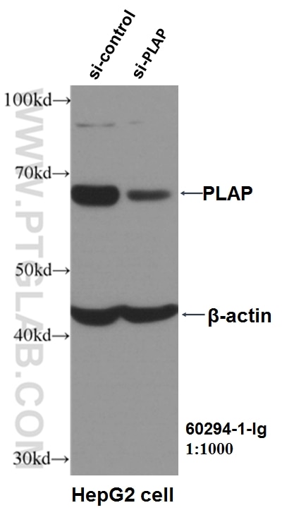 Western Blot (WB) analysis of HepG2 cells using PLAP Monoclonal antibody (60294-1-Ig)