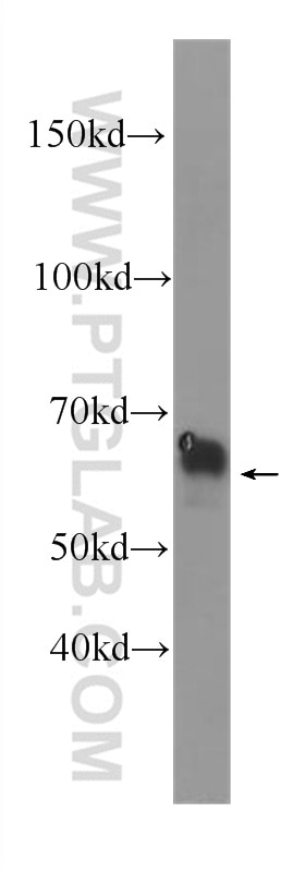 Western Blot (WB) analysis of HepG2 cells using PLAP Monoclonal antibody (60294-1-Ig)