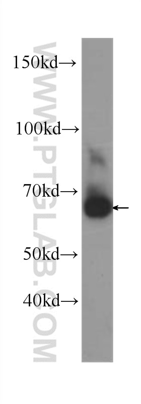 Western Blot (WB) analysis of human placenta tissue using PLAP Monoclonal antibody (60294-1-Ig)
