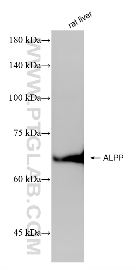WB analysis using 86752-3-RR Western Blot (WB) analysis of various lysates using PLAP Recombinant monoclonal antibody (86752-3-RR)