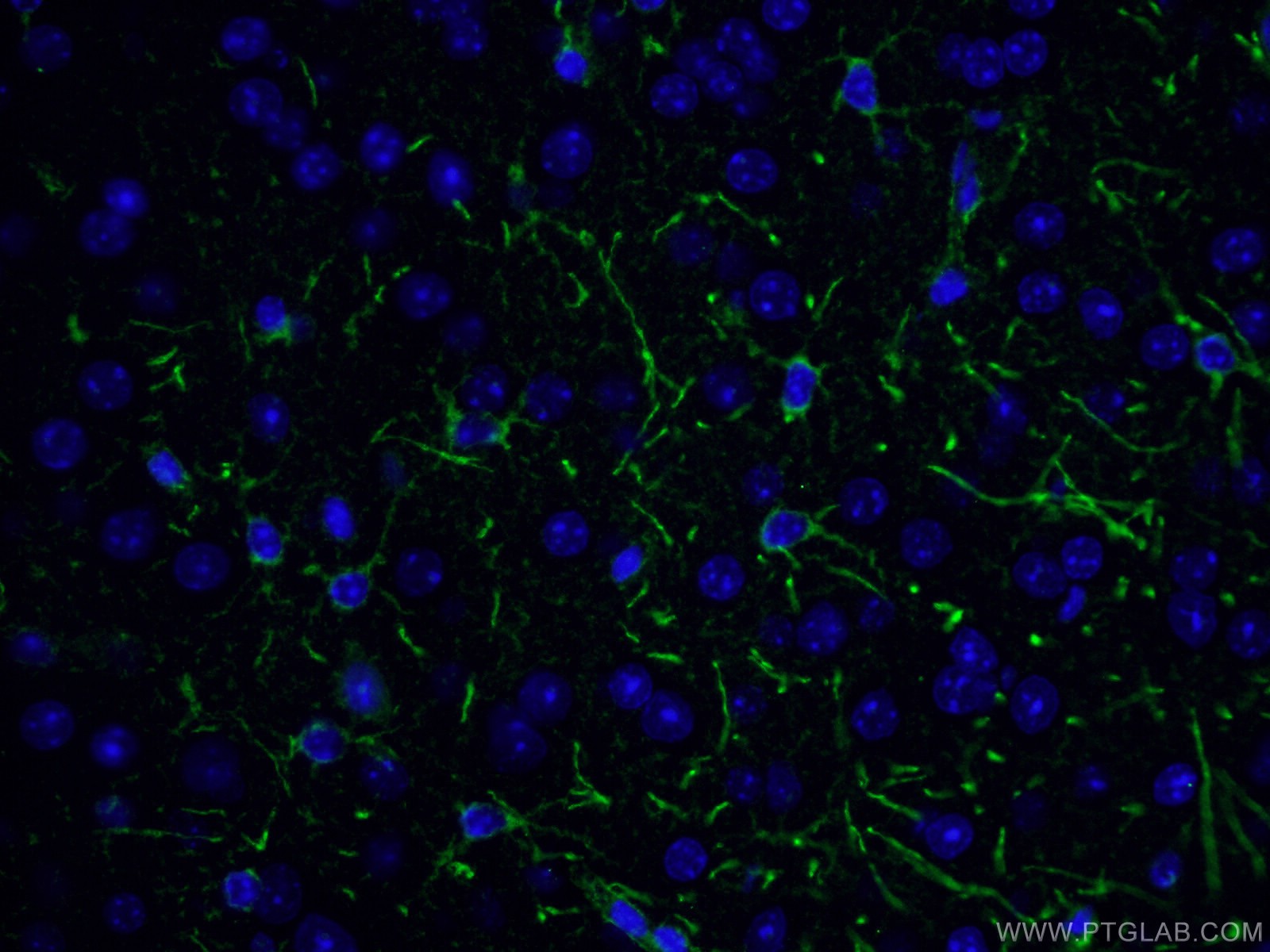 Immunofluorescence (IF) / fluorescent staining of mouse brain tissue using tPA Polyclonal antibody (10147-1-AP)