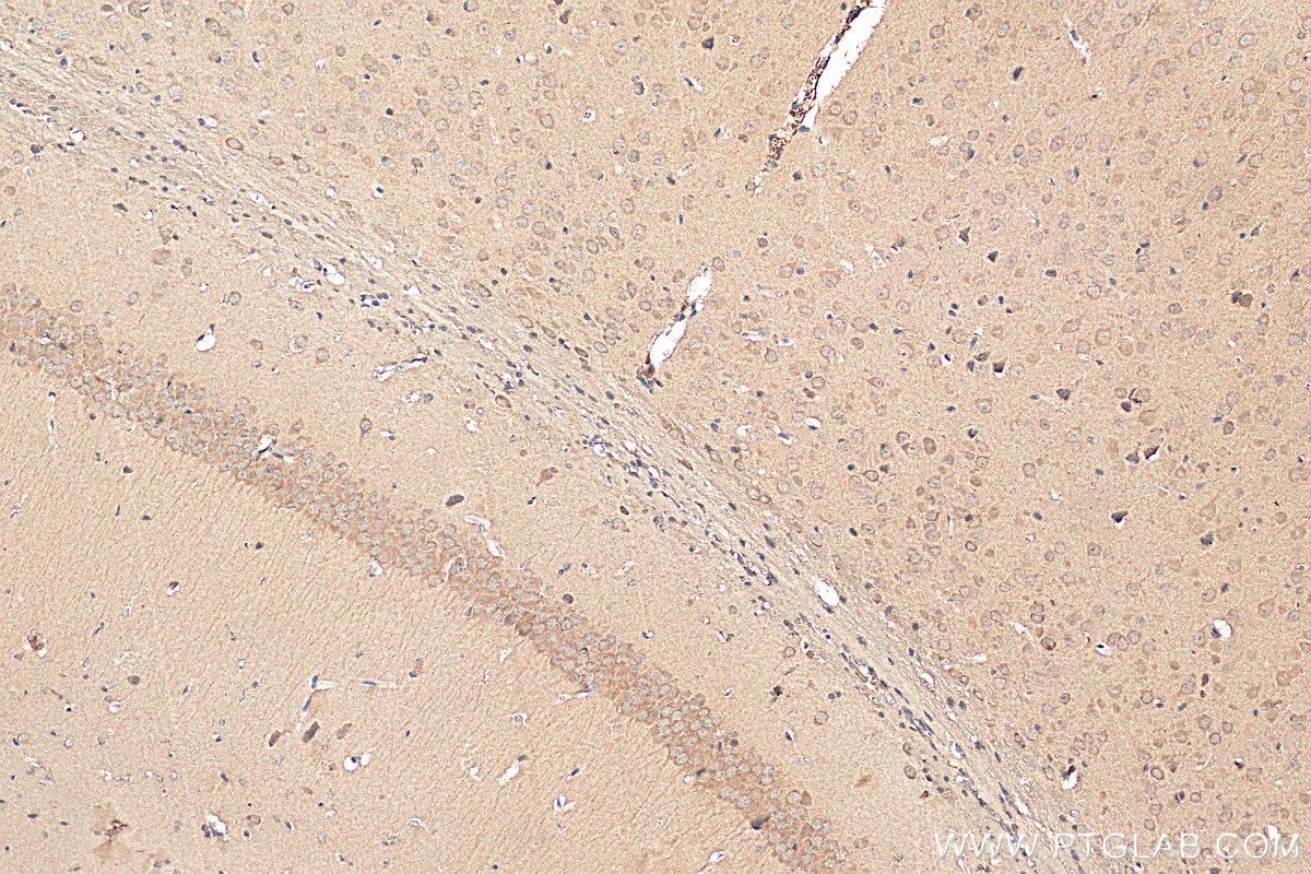 Immunohistochemistry (IHC) staining of mouse brain tissue using tPA Polyclonal antibody (10147-1-AP)