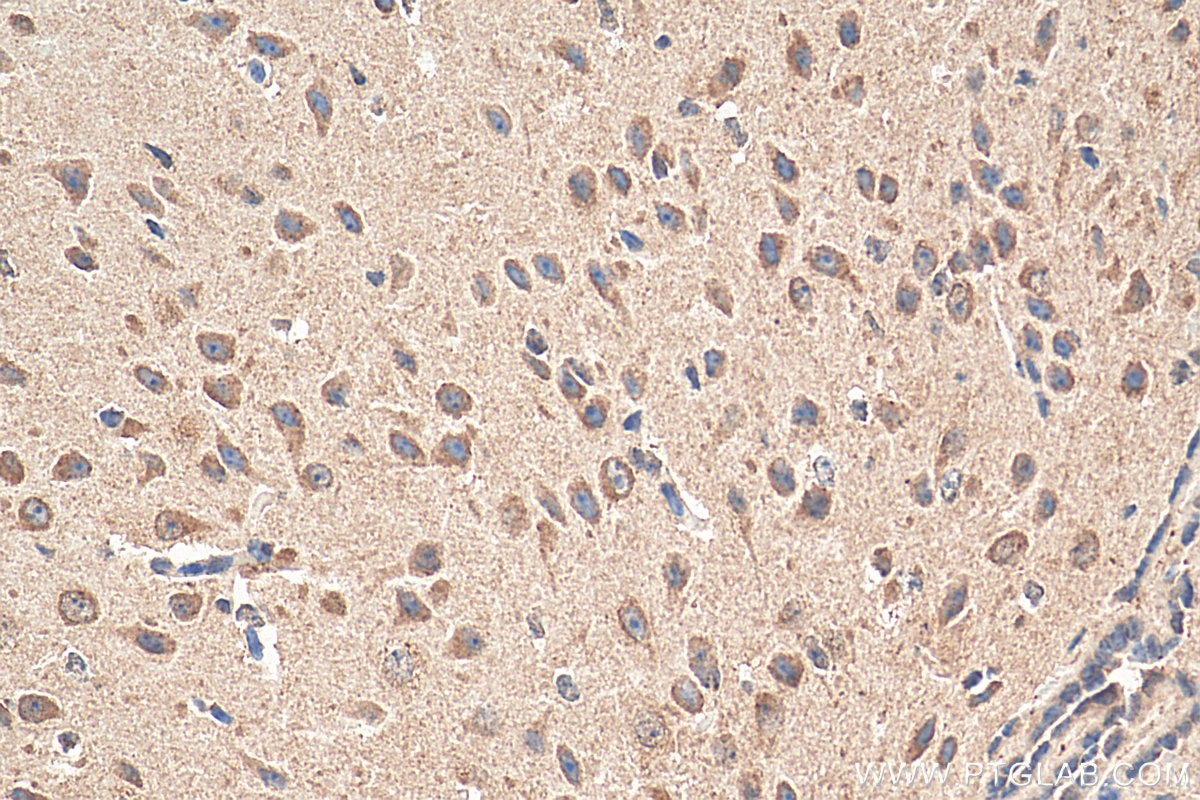 Immunohistochemistry (IHC) staining of mouse brain tissue using tPA Polyclonal antibody (10147-1-AP)