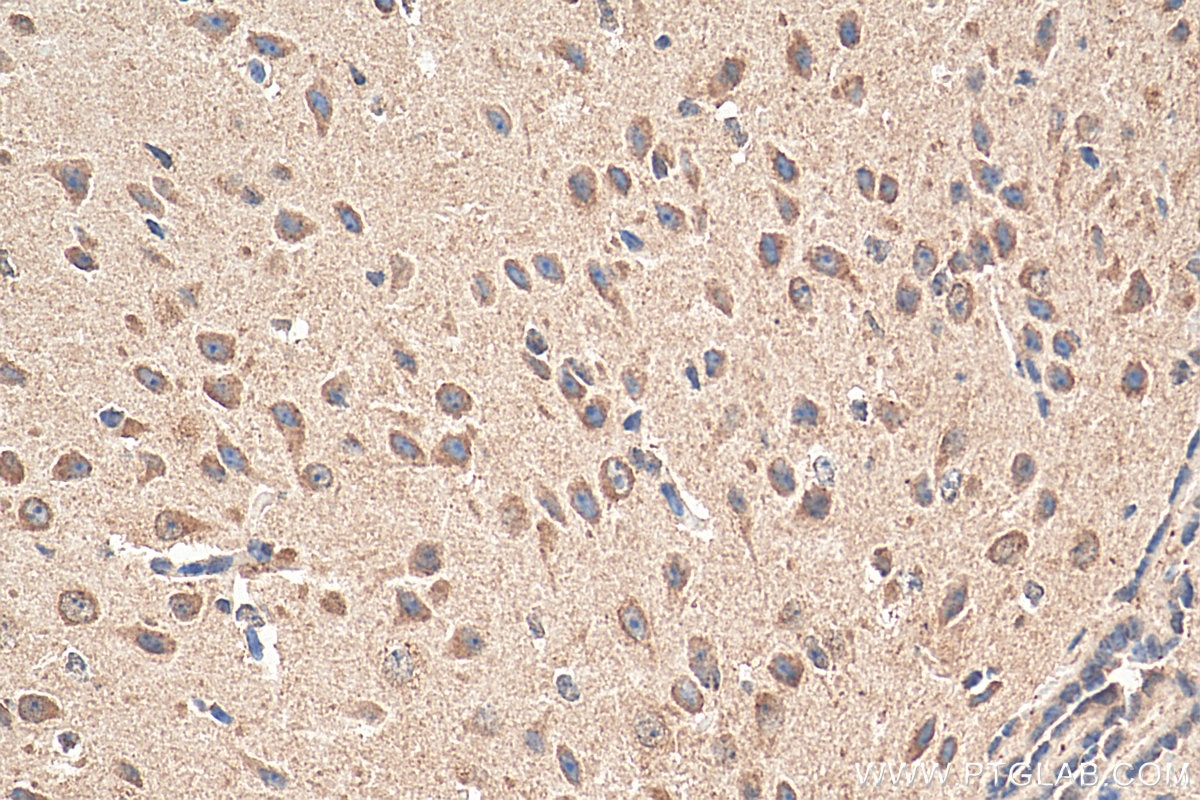 IHC staining of mouse brain using 10147-1-AP