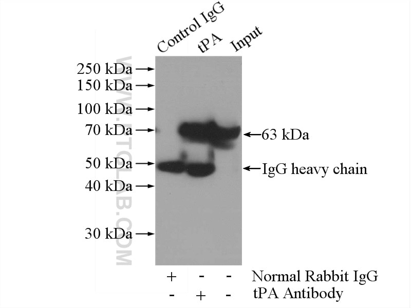 Immunoprecipitation (IP) experiment of mouse kidney tissue using tPA Polyclonal antibody (10147-1-AP)