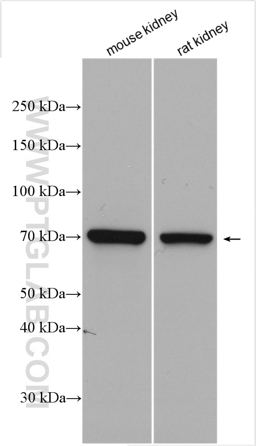 Western Blot (WB) analysis of various lysates using tPA Polyclonal antibody (10147-1-AP)